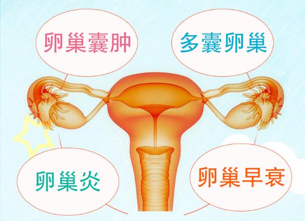 伤害卵巢的坏习惯有哪些？如何保养卵巢